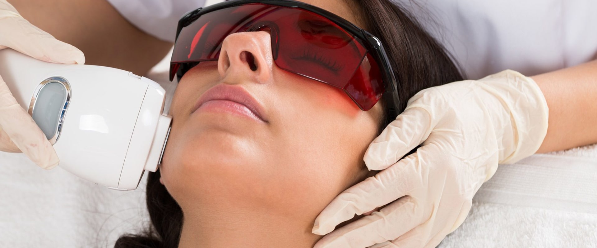 The Benefits and Drawbacks of Laser Hair Removal on the Face