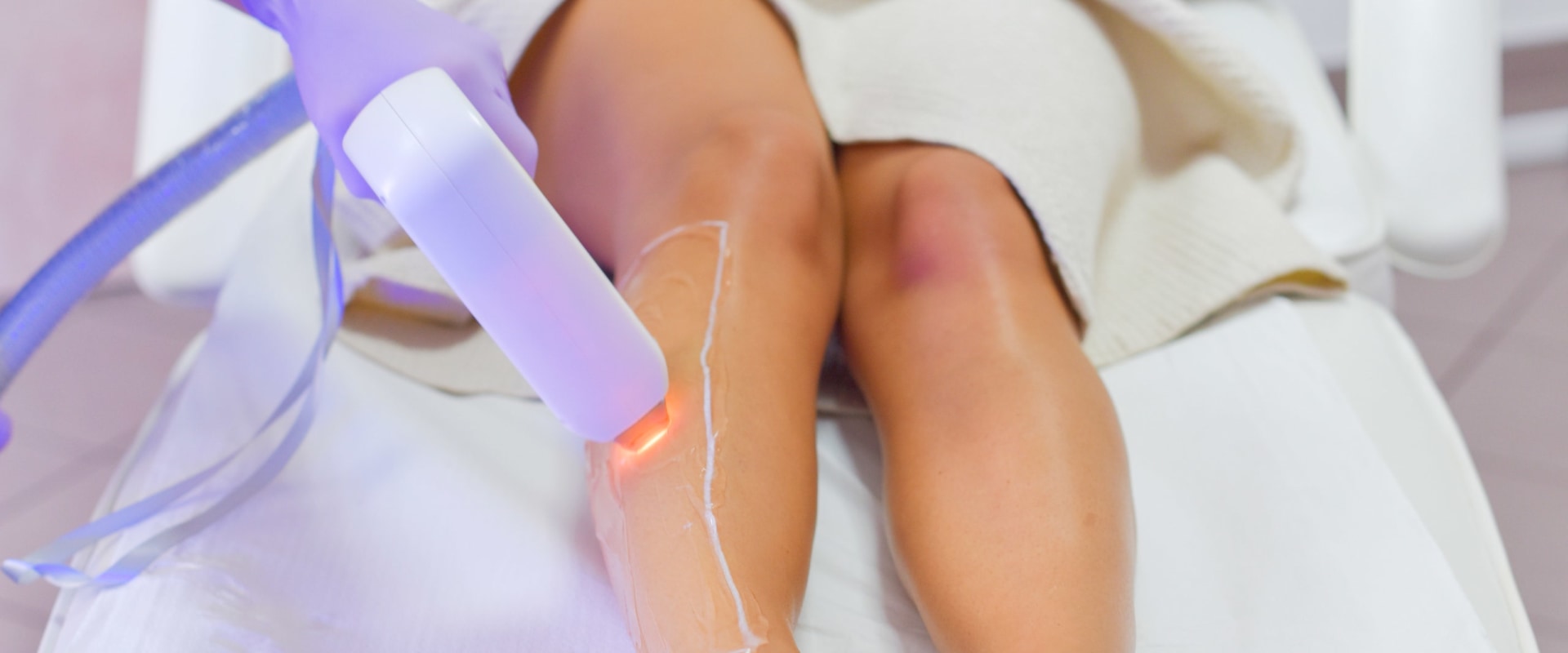 The Best Areas for Laser Hair Removal: A Comprehensive Guide