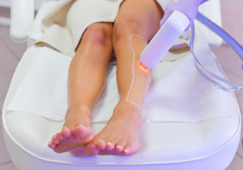 The Best Areas for Laser Hair Removal: A Comprehensive Guide