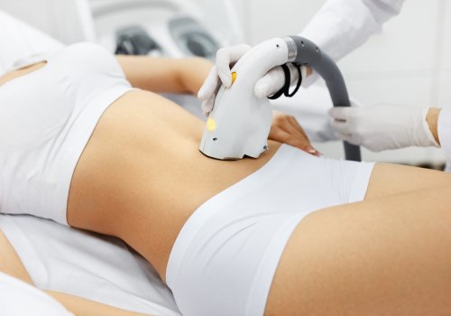 Does Laser Hair Removal Get Less Painful Over Time?