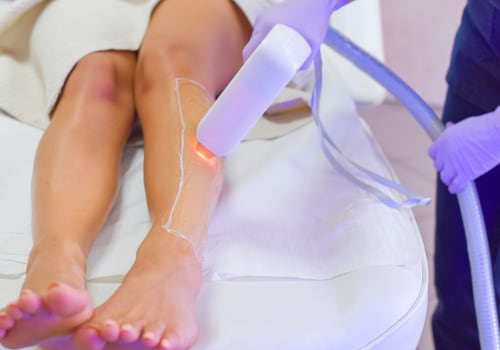 What Parts of the Body Should Not Be Treated with Laser Hair Removal?